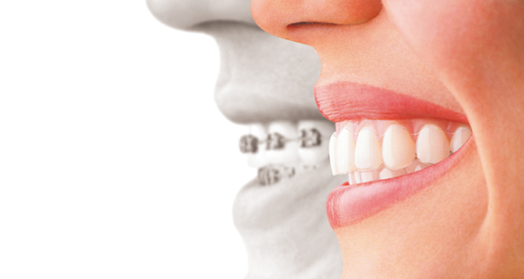 矯正治療に力を入れています